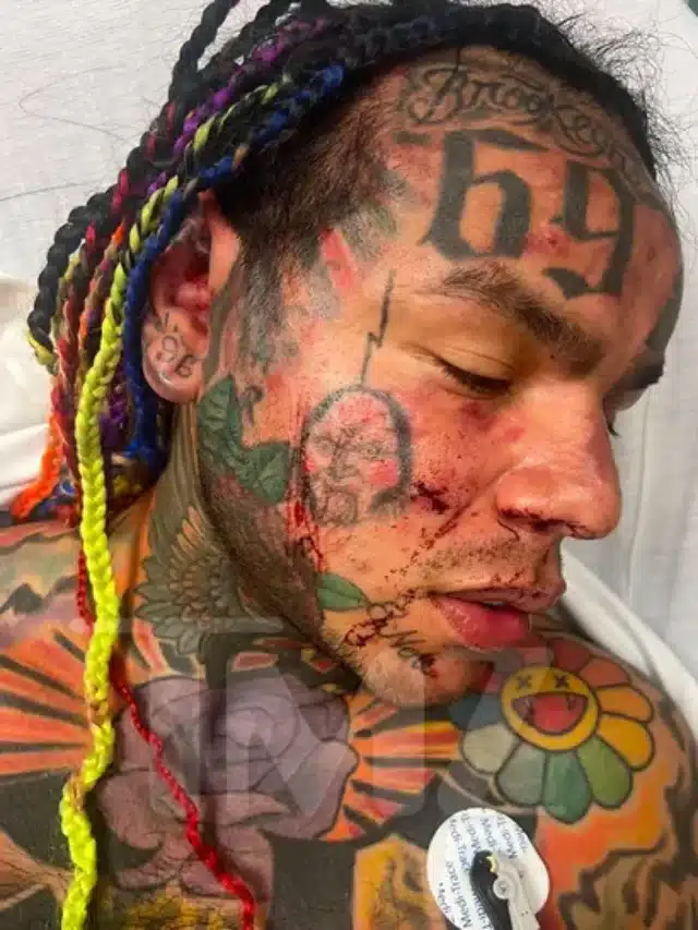 Rapper Tekashi 6ix9ine assaulted